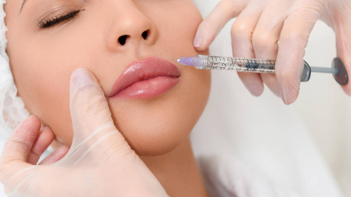 Lippen aufspritzen Bern