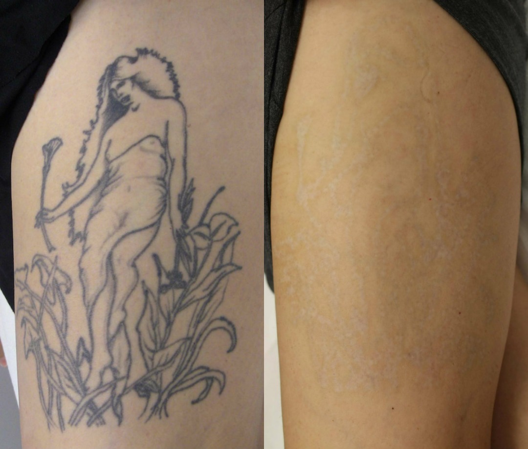 Tattoo und Permanent Make-up Bern