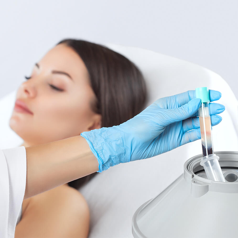 PRP-Behandlung Bern – Madame Beauty Institut Bern