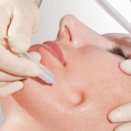 JetPeel Thun – Behandlung im Madame Beauty Institut an der Freienhofgasse