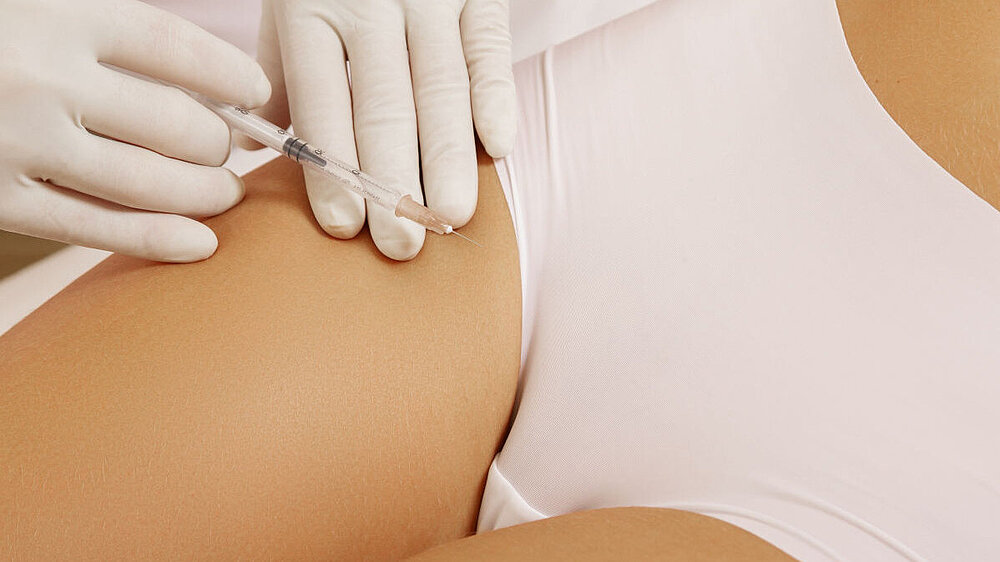 Schamlippenvergrösserung in Bern – ärztliche Behandlung mit Hyaluronsäure im Madame Beauty Institut