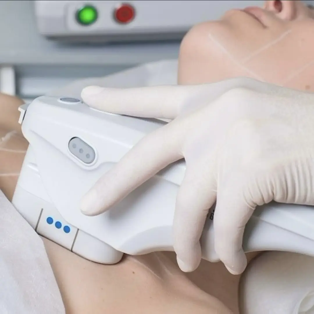 Körperstraffung in Bern mit HIFU und Radiofrequenz