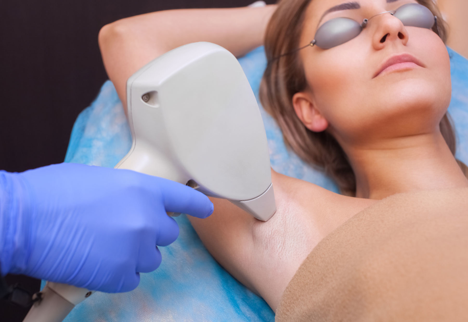 Laser Haarentfernung Bern an der Achsel mit dem Diodenlaser