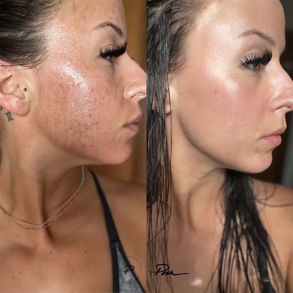 Medizinisch zertifizierter CO2- und Erbium-Laser von Asclepion im Madame Beauty Institut in Bern
